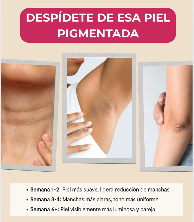 Crema Despigmentante ACLARI