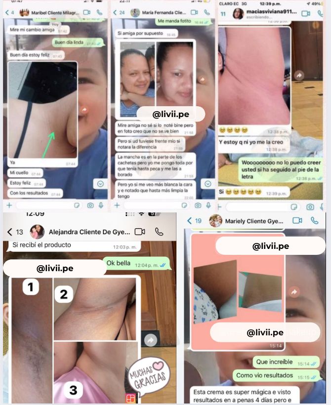 Crema Despigmentante ACLARI